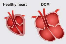 Canine dilated cardiomyopathy